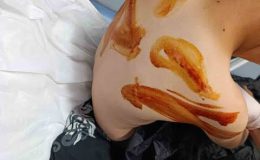 Şanlıurfa’da Vicdanları Yaralayan Olay: 11 Yaşındaki Çocuğa Komşusu Tarafından Sopalı Acımasız Dayak!