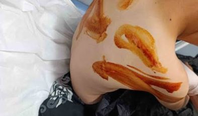 Şanlıurfa’da Vicdanları Yaralayan Olay: 11 Yaşındaki Çocuğa Komşusu Tarafından Sopalı Acımasız Dayak!