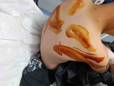 Şanlıurfa’da Vicdanları Yaralayan Olay: 11 Yaşındaki Çocuğa Komşusu Tarafından Sopalı Acımasız Dayak!