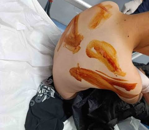 Şanlıurfa’da Vicdanları Yaralayan Olay: 11 Yaşındaki Çocuğa Komşusu Tarafından Sopalı Acımasız Dayak!