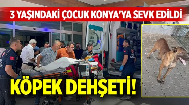 Sahibinden Kaçan Belçika Kurdu 3 Yaşındaki Çocuğa Saldırdı!
