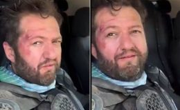 “Nalet Bebe” Lakaplı Ömer Başdoğan Motosiklet Kazası Geçirdi! Yüzündeki Yaralar Dikkate Çekti