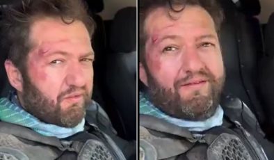 “Nalet Bebe” Lakaplı Ömer Başdoğan Motosiklet Kazası Geçirdi! Yüzündeki Yaralar Dikkate Çekti